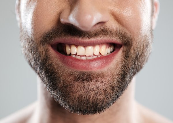 Dientes